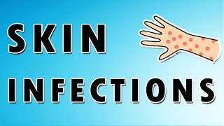 Common Skin Infections [upl. by Forster698]