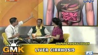 Usapang Pangkalusugan Liver Cirrhosis [upl. by Pollerd]