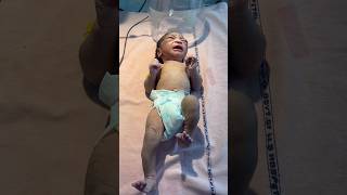 Newborn convulsiontrendingshorts viralvideo [upl. by Romilly]