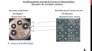 Antibiogramme  notions de base [upl. by Valentijn]