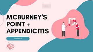 McBurneys Point and Appendicitis  Mnemonic and Explanation in Under 2 Minutes [upl. by Winslow]