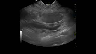 mesenteric torsion in a dog oedemahaemorrhage in the root of the mesentery [upl. by Ed]