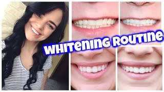 At Home Teeth whitening review by Kim A [upl. by Lielos]