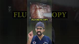 How is the Renal Embolization Procedure Performed kidneyhealth kidneyproblems [upl. by Aseyt589]