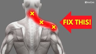 How to INSTANTLY Fix Pinched Nerve Pain in the Neck and Shoulders [upl. by Saddler]