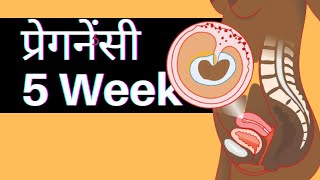 5 Weeks Pregnancy Symptoms in Hindi  Week by Week Pregnancy  5 हफ्ते की प्रेगनेंसी ke lakshan [upl. by Ettesyl950]