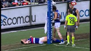 Tom Campbell vs the goalpost  AFL [upl. by Nagaem]