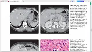 LIVER DIAGNOSTIC IMAGING SERIES [upl. by Anita]