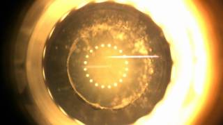 Capsulotomy treatment laser femto Victus wmv [upl. by Barfuss]