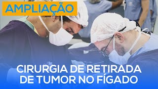 CIRURGIA de RETIRADA de TUMOR no FÍGADO  Nova especialidade no Oeste Paulista [upl. by Hashum]