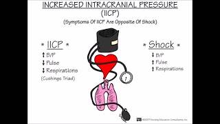 ICP and the ECG [upl. by Lansing]