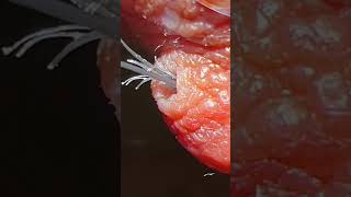 Top 3 Compilation Ingrown hair removal [upl. by Niveek]