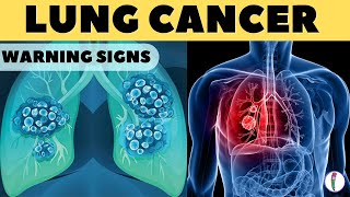 Lung Cancer Warning Signs II Lung Cancer Symptoms [upl. by Ati]