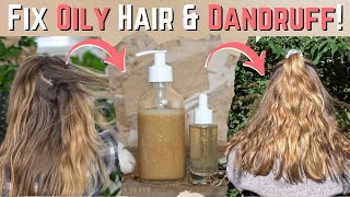 Say Goodbye to Dandruff amp Oily Scalp 💧 Homemade Shampoo amp Serum Recipe for Soft Shiny Hair✨ [upl. by Noiz216]