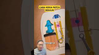 Cara Kerja Patch Insulin 🤔 doctor science [upl. by Ailemak]