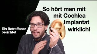 So hört man mit Cochlea Implantat wirklich Ein Betroffener erzählt [upl. by Marge]