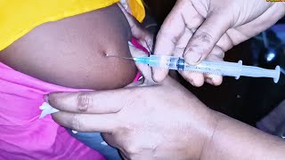 IM Intramuscular Arm injection Push Ketorolac 30 mg Xerokit 24 Ep 106 Anik Health Tips [upl. by Naahs]