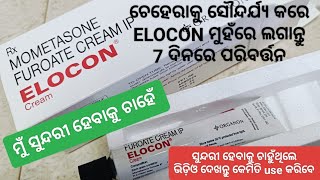 ମୁଁ ସୁନ୍ଦରୀ ହେବାକୁ ଚାହେଁ  Elocon  Mometasone Furoate Cream  ଚେହେରା ସୌନ୍ଦର୍ଯ୍ୟ ବଢ଼ାନ୍ତୁ 7ଦିନରେ [upl. by Alysia]