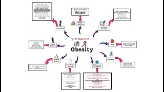 Obesity  OSCE [upl. by Merce690]