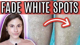 How to FADE WHITE SPOTS from SUN DAMAGE  Dr Dray [upl. by Spears810]