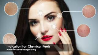 Chemical Peel  Cost Risks Recovery amp Types of Facial Peels at Chennai Plastic Surgery [upl. by Eniksre]