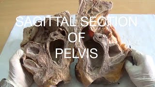 SAGITTAL SECTION OF PELVIS  DEMONSTRATION  ANATOMY [upl. by Etnoval744]