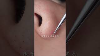 immersive skin care strawberry nose blackhead deep pore cleaning skin management [upl. by Aicekat]