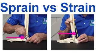 Sprain vs Strain Understanding the Key Differences [upl. by Ahsikrats526]