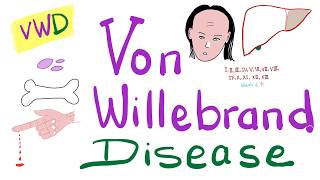 Von Willebrand Disease vWD  The Most COMPREHENSIVE Explanation  Hematology [upl. by Geehan763]