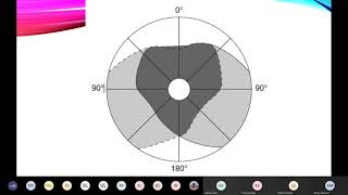 Physiology Perimetry amp Effect of Lision of Visual Pathway Mr Pandian [upl. by Cutlor366]