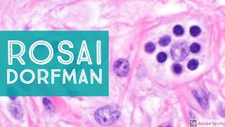 Extranodal RosaiDorfman Disease 101Explained by a Pathologist [upl. by Baily149]