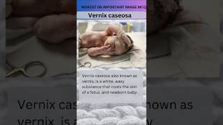 Vernix caseosa Norcet 08 important image Base mcq  Maternity nursingytviralshort [upl. by Mighell]