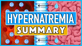 Hypernatremia Summary [upl. by Slayton]