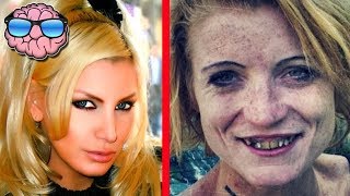 Top 10 Shocking Before And After Drug Use Photos [upl. by Marlene]