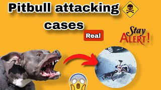 I Survived A Pit Bull Attack [upl. by Libenson46]