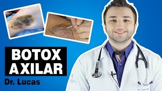 Saiba tudo sobre Botox Axilar para hiperidrose axilar [upl. by Aitak]