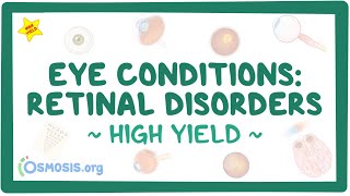 Eye conditions  Retinal disorders Pathology review [upl. by Nav155]