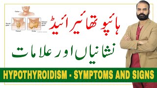 Hypothyroidism Symptoms and signs in UrduHindi [upl. by Asenev]