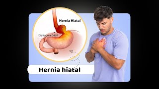 Cirugía de Hernia hiatal  reflujo Acalasia [upl. by Eissen]