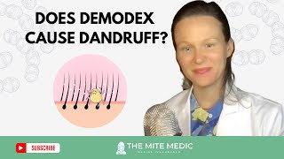 THE HIDDEN CAUSE OF DANDRUFF Demodex Mites and itchy scalp [upl. by Lazaruk]