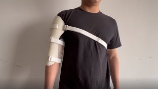 Humeral Fracture Splint for Broken Humerus [upl. by Maurise]