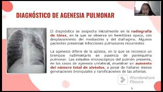 Agenesia pulmonar [upl. by Bullock]