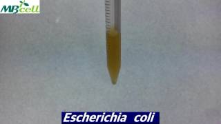 Enterobacteriaceae Enrichment Broth [upl. by Arob]