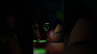 Speed hack en l4d2 shorts l4d2versus left4dead2funnymoments gaming momentazos [upl. by Jane662]