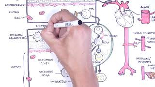 Vasculitis Pathophysiology Overview [upl. by Eirahcaz]