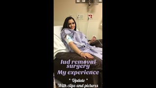 Iud removal surgery my experience update with clips and pictures [upl. by Borchers]