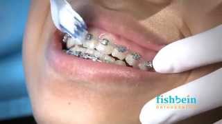 Orthodontic Home Care Instructions  Braces  Brushing [upl. by Delle]