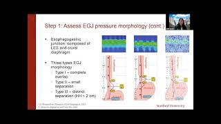 ANMS Clinical Virtual Webinar  Esophageal Manometry When Why and How [upl. by Anida]