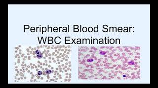 Peripheral blood Smear WBC examination [upl. by Harriot]