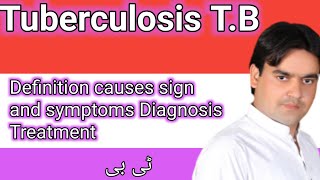 Tuberculosis  Dr Mushtaq lectures [upl. by Leerzej]